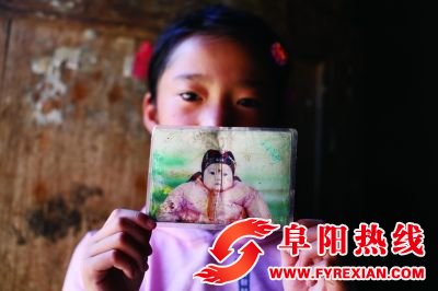 安徽阜阳“大头娃娃”10年后手指仍伸不直(图)